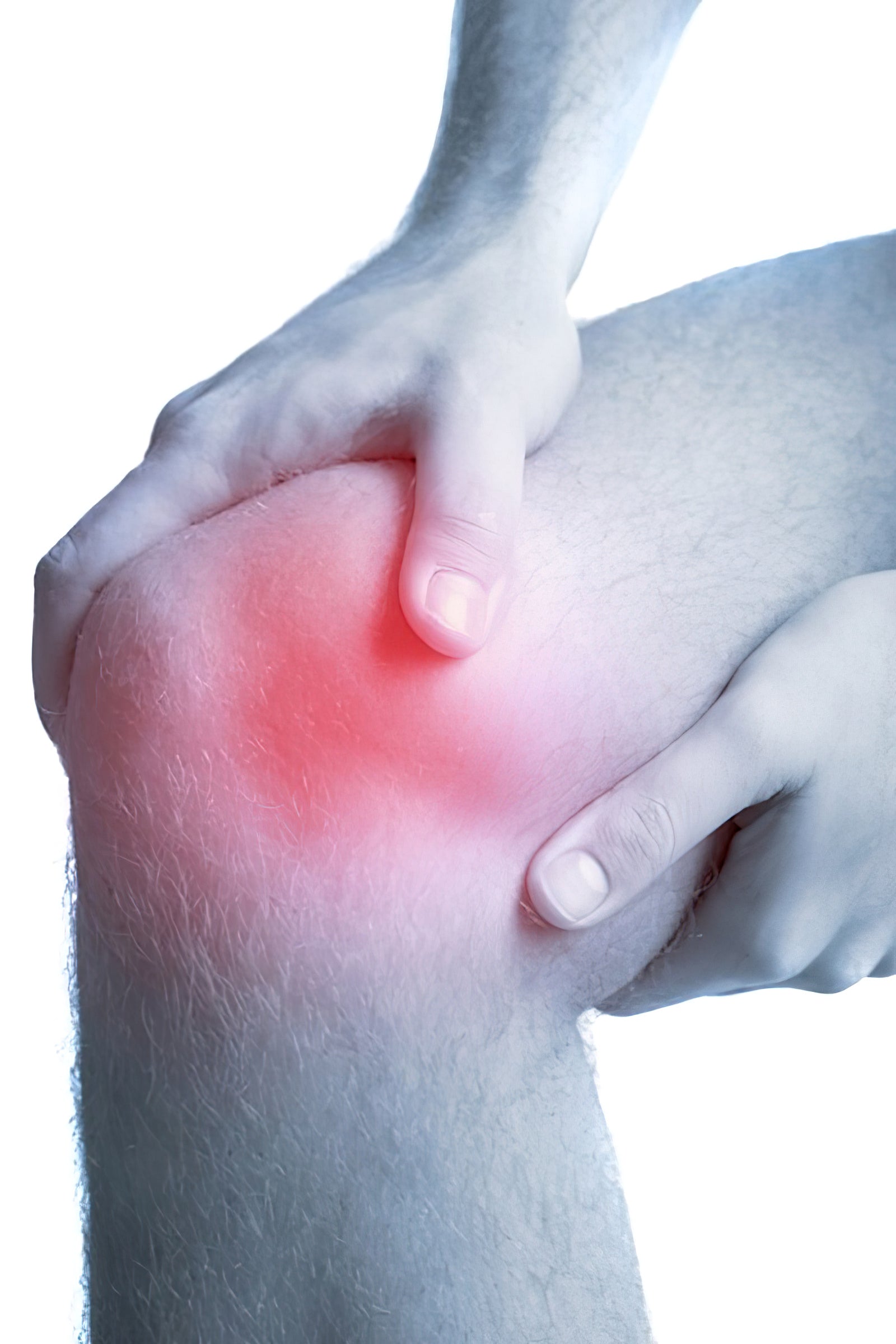 Pycnogenol reduziert Arthritis Knieschmerzen