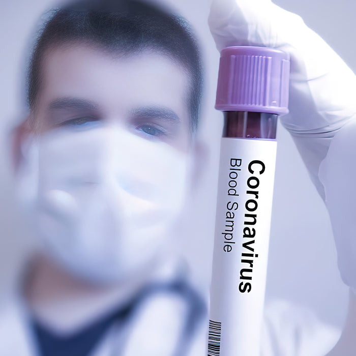 Alles was Du über den Coronavirus (COVID-19) wissen musst